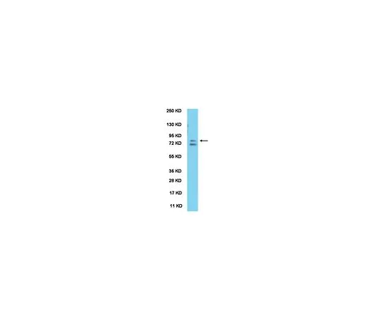 62-8446-40　抗ABBA;100μL　AB2209