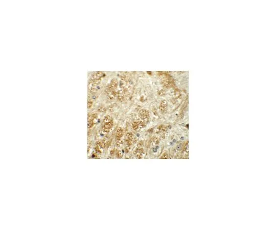 62-8467-47　抗ATP2C1　ABN479