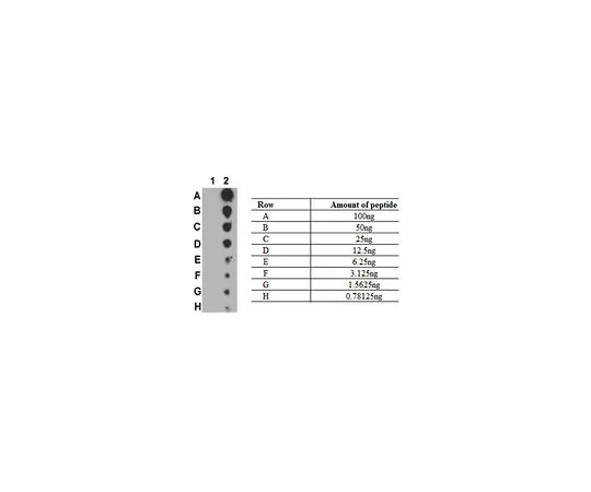 62-8388-43　抗磷-NF-kB (p100) (Ser707)　07-1829