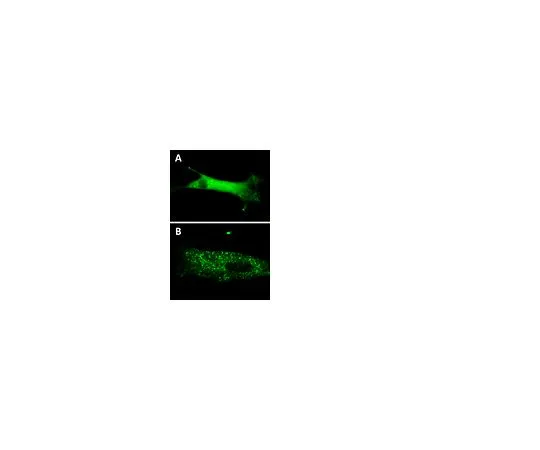 62-8394-61　慢Brite (TM) GFP-p62慢病毒生物传感器　17-10224