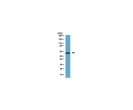 62-8387-85　抗钙调神经磷酸酶Aα;100μL　07-1492