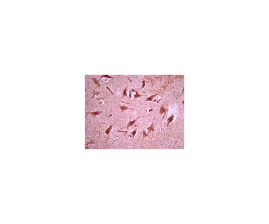 62-8465-26　抗多巴胺D (1A) 受体;100μg　ABN20
