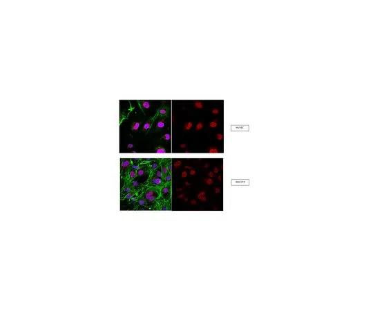 62-8461-28　抗RNF168;100μg　ABE367