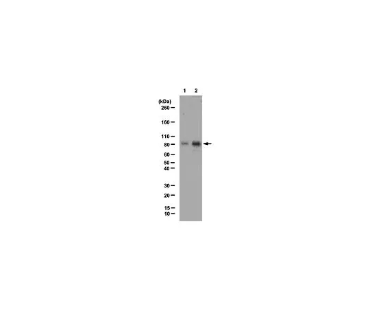 62-8390-18　抗乙酰 酸;100μg　09-881