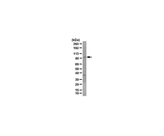 62-8386-31　抗FOXO3a/FKHRL1;100μg　07-702