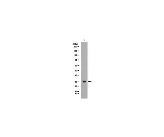 62-8382-55　反TRICA;100μg　06-1005