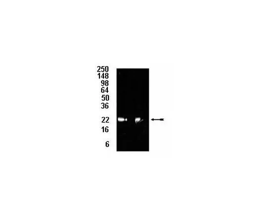 62-8389-60　抗20S蛋白酶体亚基β5;100μL　09-278