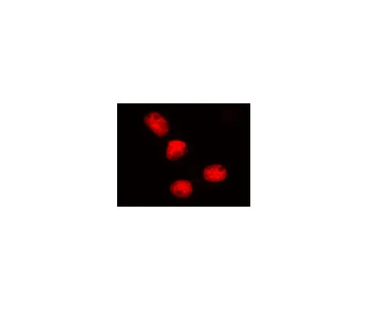 62-8394-64　慢Brite (TM) 组蛋白H2B-RFP慢病毒生物传感器　17-10228