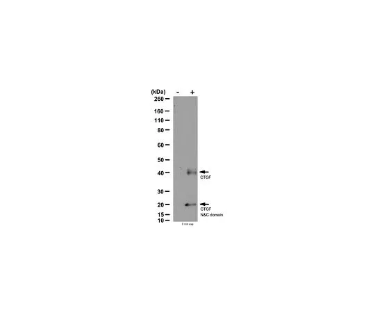 62-8387-51　抗连接组织生长因子;100μg　07-1386