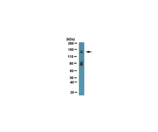 62-8452-35　反整合素α-11;100μg　AB6031