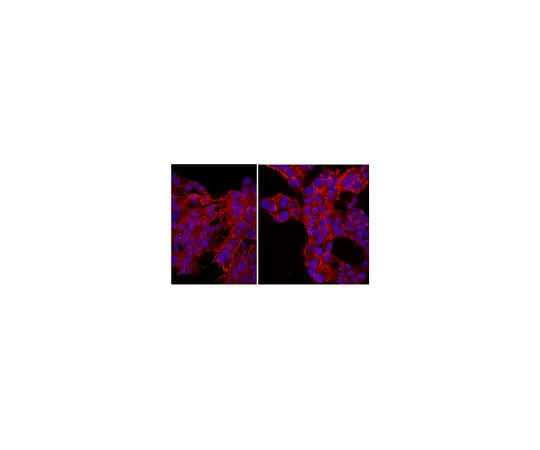 62-8449-70　抗NG2硫酸软骨素蛋白多糖，Cy3共轭;100μL　AB5320C3