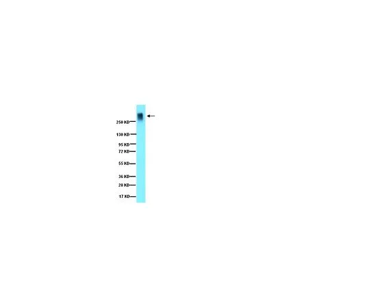 62-8444-72　反激进主义;50μg　AB1031