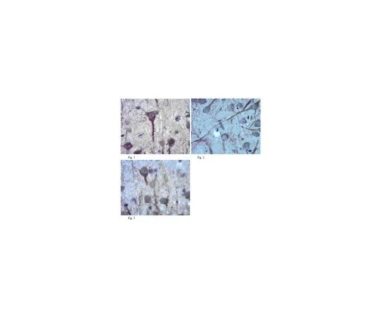 62-8465-74　抗纽瑞欣-1α;100μg　ABN98