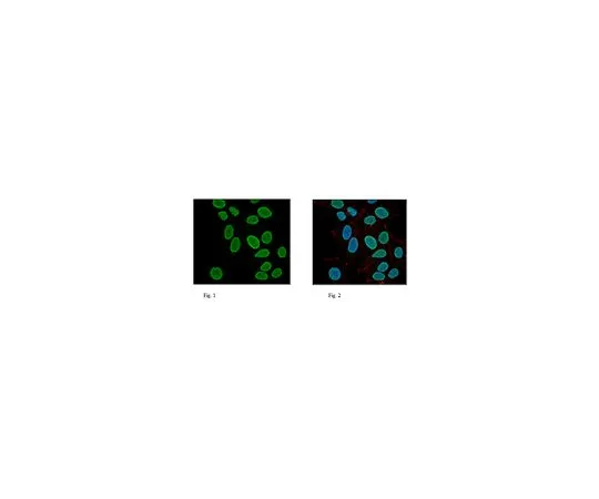 62-8382-06　抗组蛋白H3;100μg　06-755