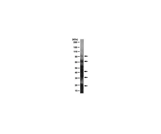 62-8493-42　抗DNP,克隆9H8.1;100μg　MAB2223