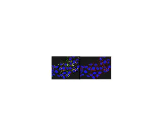62-8522-25　反泛Ras,克隆RA 10;100μg　MABS195