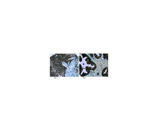 62-8472-41　抗凝固剂5;100μg　ABT45
