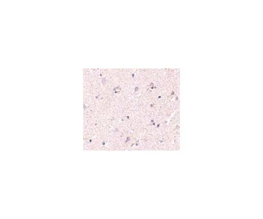 62-8473-72　反NANOS1　ABT337