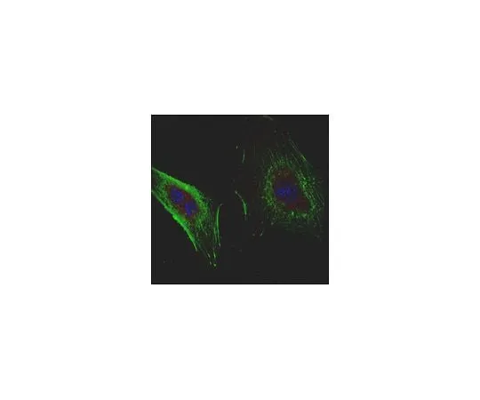 62-8523-88　抗Derlin-1抗体，克隆8G11.2　MABS1154
