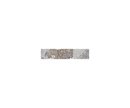 62-8508-34　抗SMARCA3 (HLTF) ，克隆11-1　MABE1074