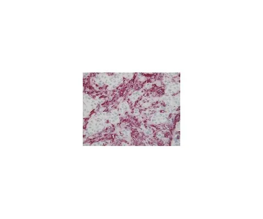 62-8494-70　抗波形蛋白，克隆V9;40μg　MAB3400