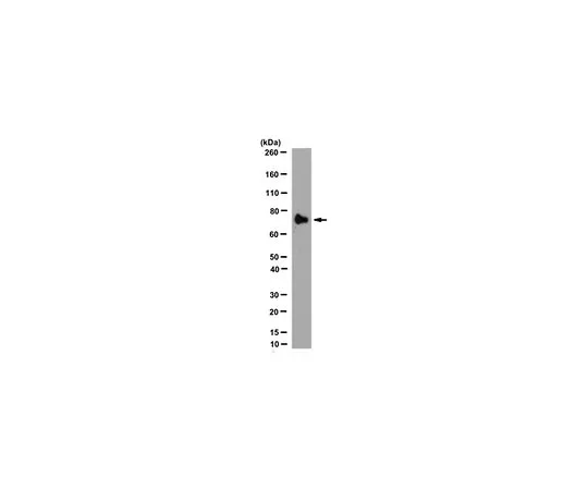 62-8525-85　Anti-MMP-9 (Active) ，克隆4A3　MABT171
