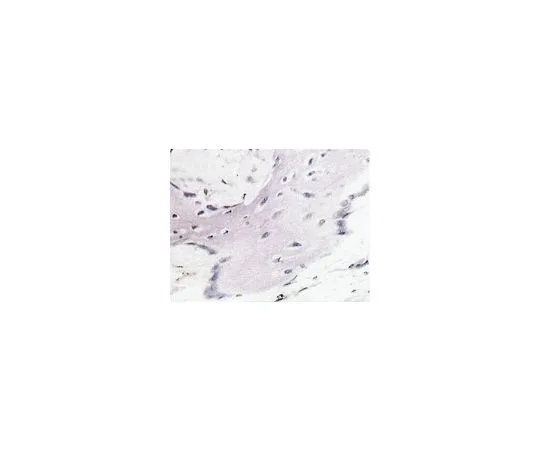 62-8490-26　抗Bone唾液蛋白II, C末端，克隆ID1.2;100μg　MAB1061
