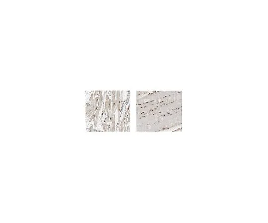 62-8507-35　抗26S蛋白酶体非ATP酶调节亚单位14　MABE881
