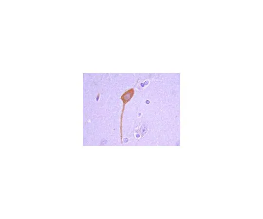 62-8497-80　抗GAD67,克隆1G10.2;100μg　MAB5406