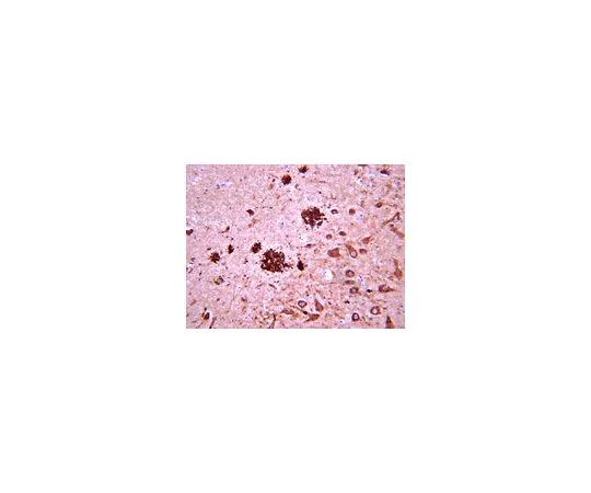 62-8516-31　抗淀粉样蛋白β，克隆W0-2;50μg　MABN10