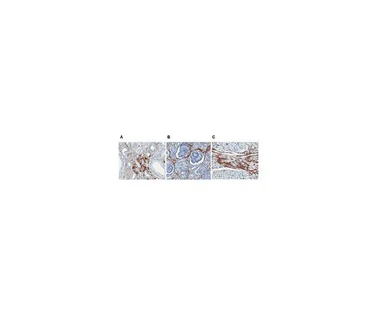 62-8492-32　抗Laminin-5,克隆P3E4;100μg　MAB1949