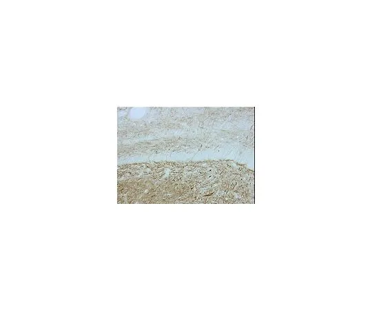 62-8497-36　抗神经丝200 kDa,克隆N52;50μg　MAB5266