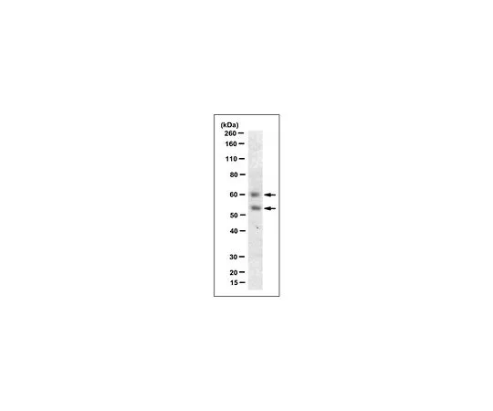 62-8519-98　抗Myocilin (NT) 抗体，克隆7.1　MABN866
