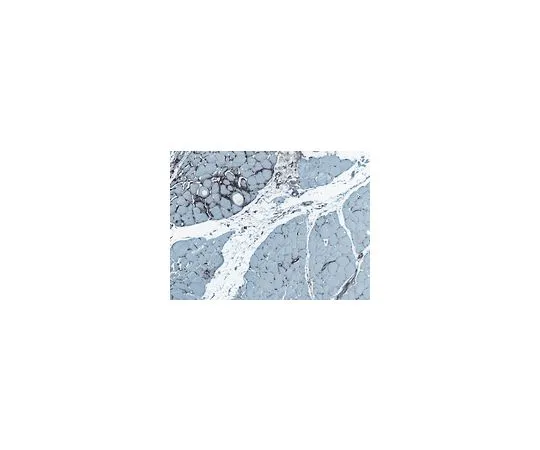 62-8479-57　抗成纤维细胞，克隆TE -7;100μg　CBL271