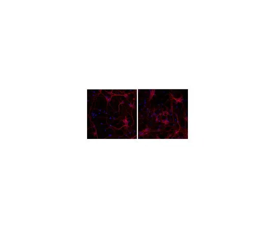 62-8479-67　抗Tubulinβ-III,克隆TU-20, Alexa Fluor (R) 555共轭;100μL　CBL412A5