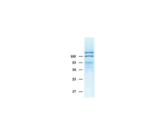 62-8480-48　人整合素αVbeta3,TritonX-100制剂;50μg　CC1019