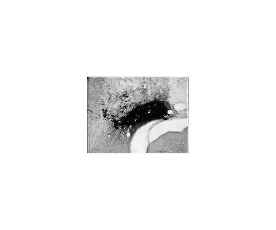 62-8489-35　抗多巴胺β-羟化酶-SAP (皂苷结合) ，克隆4F10.2;250μg　MAB394-250UG