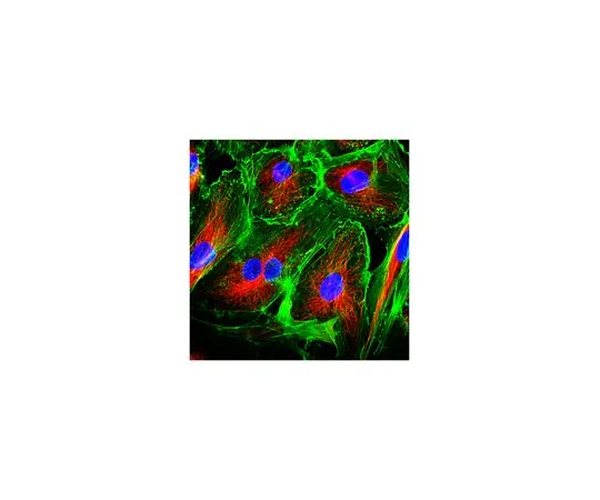 62-8491-97　抗α-球蛋白抗体，酪氨酸，克隆YL1/2　MAB1864-I