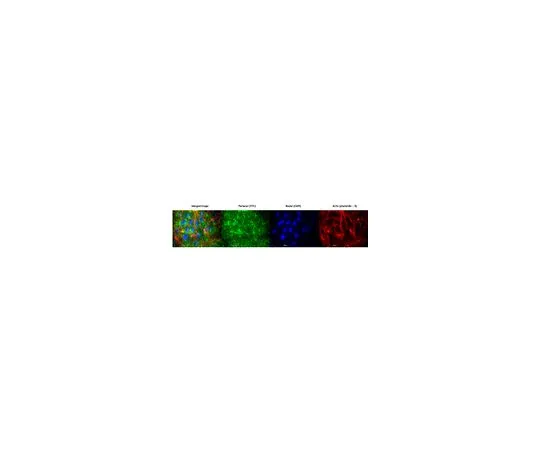 62-8525-13　抗硫酸乙酰肝素蛋白多糖，克隆5D7-2E4;100μg　MABT12