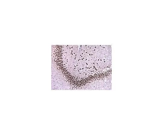 62-8516-41　抗共济失调-1,11NQ,克隆N76/8;100μg　MABN37