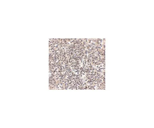 62-8470-01　抗RSPO1　ABS437