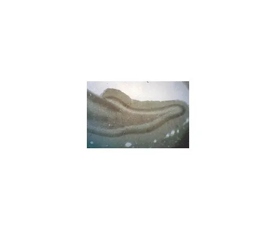 62-8497-14　抗磷酸盐，克隆122.2;100μL　MAB5210