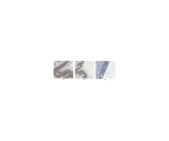 62-8473-44　抗Galtin-7　ABT277