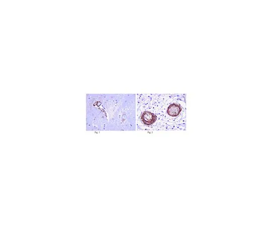 62-8516-43　抗LRRK2,克隆N138/6;100μg　MABN40