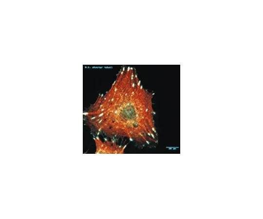 62-8492-70　抗整合素αV,克隆LM142;100μL　MAB1978