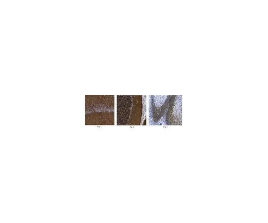 62-8498-55　抗DSD-1,克隆473HD　MAB5790-I
