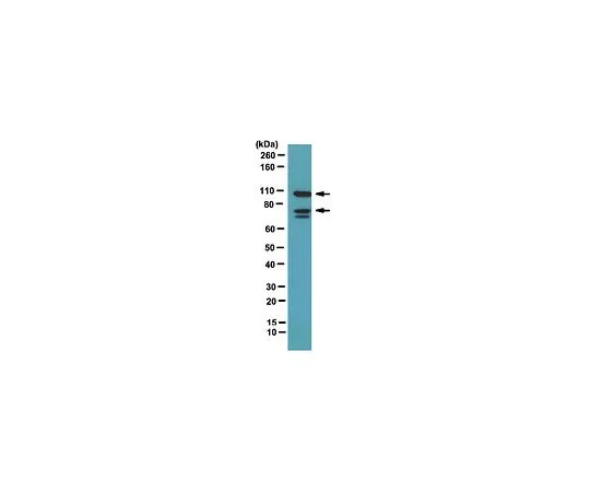 62-8472-27　抗磷脂素II;100μL　ABT21