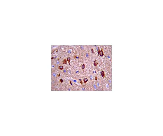 62-8491-23　反朊蛋白，a.a。109-112,克隆3F4;100μg　MAB1562