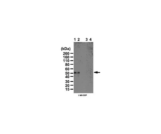 62-8472-45　抗磷PKA-RII (Ser96);100μL　ABT58