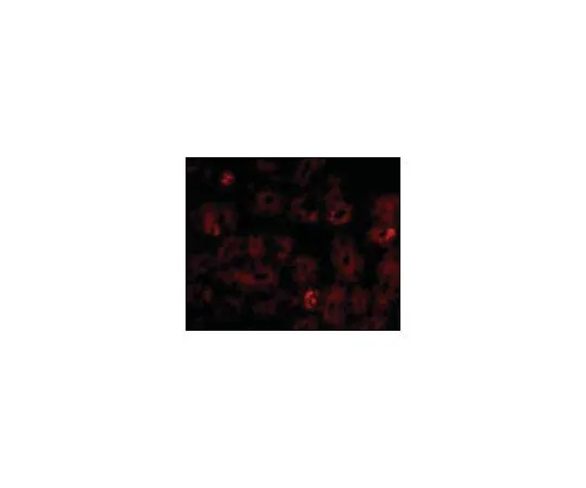 62-8471-06　抗NOTUM　ABS762